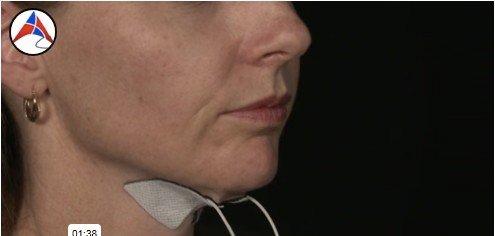 ESP: Effective Swallowing Protocol tanıtım videosu